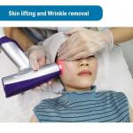 Microneedling RF Fractional Radio Frequency Beauty Equipment Facelift Skin Tight