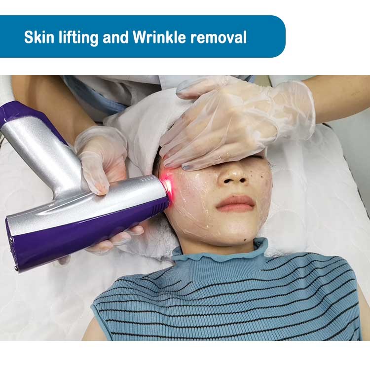 Rf Power Microneedling Fractional Rf Microneedle Scarlet Device With Vacuum
