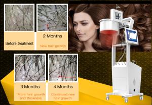 Wholesale 650nm Laser Hair Growth Machine Scalp Treatment Regrowth Salon Equipment from china suppliers