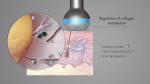 High Frequency Ultrasound Wrinkle Removal Machine Anti Aging LDM Water Drip