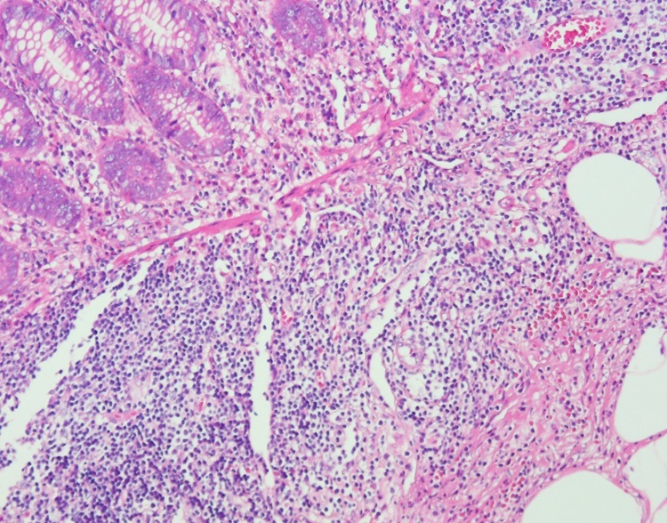 Hospital Application Hematoxylin Solution Mayer'S 1000ml Microbiology Stains