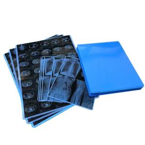 Wholesale Medical Blue X - Ray Film For Laser Printing Medical Hosiptal Consuables from china suppliers