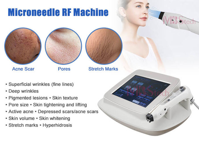 3.5 Mm Depth 5mhz Fractional Rf Microneedle Machine