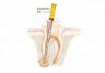 Motor Dental Niti Endo Rotary Files Barbed Broaches Apex Locator