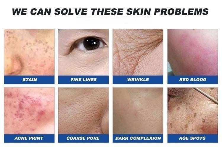 Skin Resurfacing Er Yag Laser Machine Super Penetration Wrinkle Removal Device