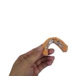 3D Printing Removable Dental Crown Framework Models For Dentistry